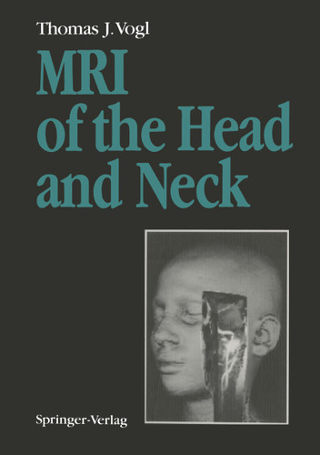 MRI of the Head and Neck: Functional Anatomy — Clinical Findings — Pathology — Imaging book cover by Thomas J. Vogl