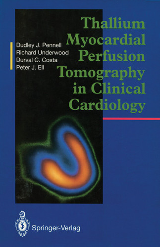 Thallium Myocardial Perfusion Tomography in Clinical Cardiology book cover by Dudley J. Pennell, S.Richard Underwood, Durval C. Costa, Peter J. Ell