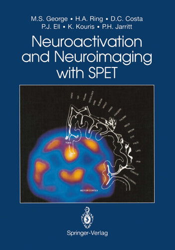 Neuroactivation and Neuroimaging with SPET book cover by Mark S. George, Howard A. Ring, Durval C. Costa, Peter J. Ell, Kypros Kouris, Peter H. Jarritt