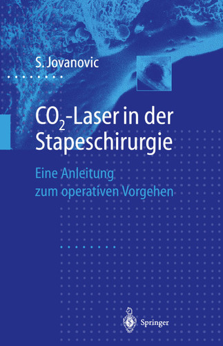 CO2-Laser in der Stapeschirurgie: Eine Anleitung zum operativen Vorgehen book cover by Sergije Jovanovic