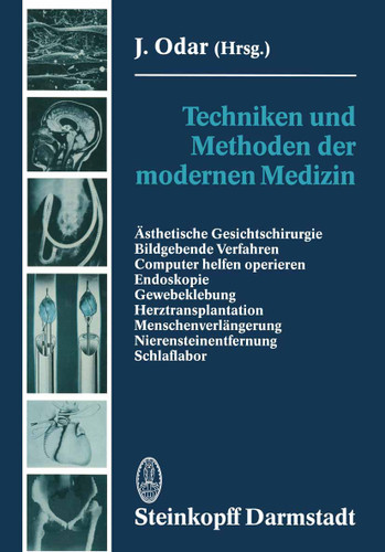 Techniken und Methoden der modernen Medizin: Ästhetische Gesichtschirurgie Bildgebende Verfahren Computer helfen operieren Endoskopie Gewebeklebung Herztransplantation Menschenverlängerung Nierensteinentfernung Schlaflabor book cover by J. Odar