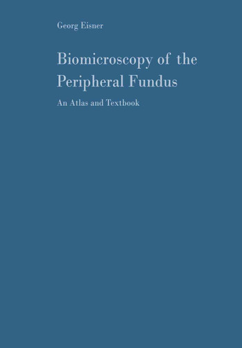 Biomicroscopy of the Peripheral Fundus: An Atlas and Textbook book cover by Georg Eisner