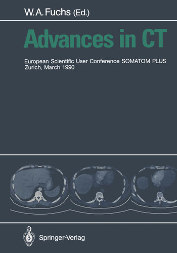 Advances in CT: European Scientific User Conference SOMATOM PLUS Zurich, March 1990 book cover by 