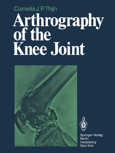 Arthrography of the Knee Joint book cover by C.J.P. Thijn