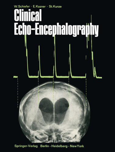 Clinical Echo-Encephalography book cover by Wolfgang Schiefer, Ekkehard Kazner, Stefan Kunze