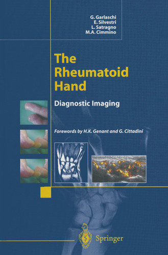 The Rheumatoid Hand: Diagnostic Imaging book cover by G. Garlaschi, E. Silvestri, L. Satragno, M.A. Cimmino