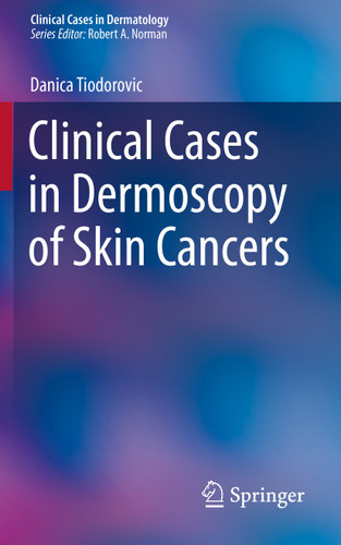 Clinical Cases in Dermoscopy of Skin Cancers (Clinical Cases in Dermatology) book cover by Danica Tiodorovic