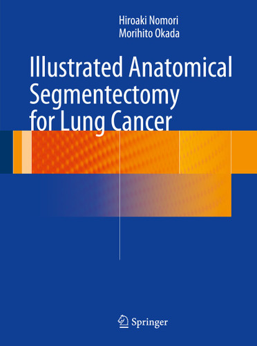 Illustrated Anatomical Segmentectomy for Lung Cancer book cover by Hiroaki Nomori, Morihito Okada