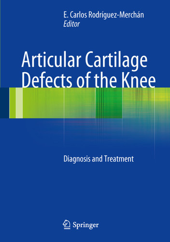 Articular Cartilage Defects of the Knee: Diagnosis and Treatment book cover by 