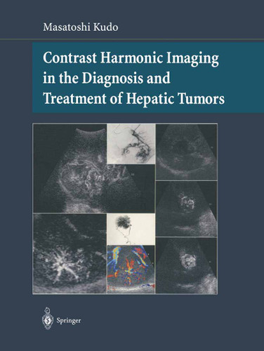 Contrast Harmonic Imaging in the Diagnosis and Treatment of Hepatic Tumors book cover by Masatoshi Kudo
