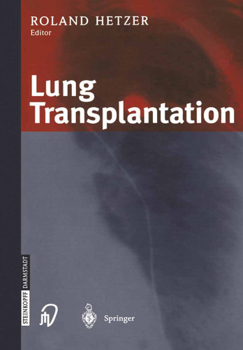 Lung Transplantation book cover by 