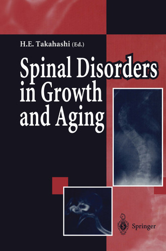 Spinal Disorders in Growth and Aging book cover by 