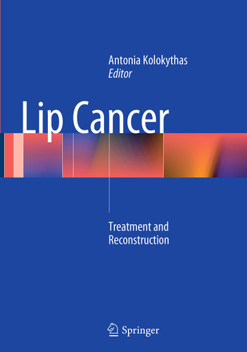 Lip Cancer: Treatment and Reconstruction book cover by 