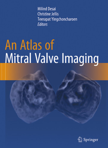 An Atlas of Mitral Valve Imaging book cover by 