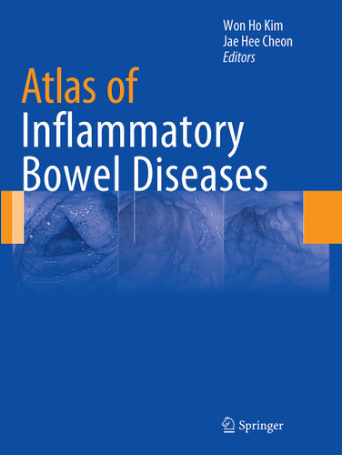 Atlas of Inflammatory Bowel Diseases book cover by 