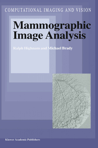 Mammographic Image Analysis (Computational Imaging and Vision #14) book cover by R. Highnam, J.M. Brady