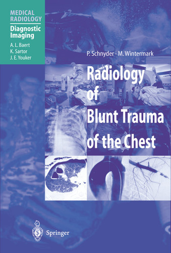 Radiology of Blunt Trauma of the Chest (Medical Radiology) book cover by P. Schnyder, M. Wintermark
