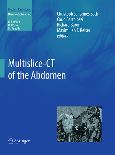 Multislice-CT of the Abdomen (Medical Radiology) book cover by 