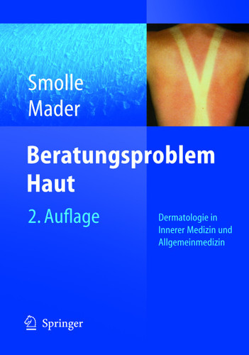 Beratungsproblem Haut: Dermatologie in Innerer Medizin und Allgemeinmedizin book cover by Josef Smolle, Frank H. Mader