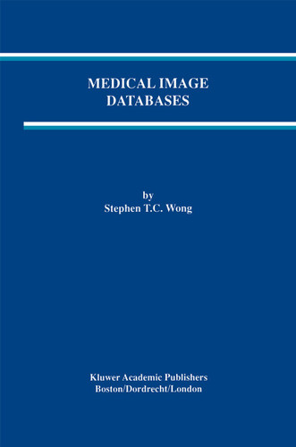 Medical Image Databases (The Springer International Series in Engineering and Computer Science #465) book cover by 