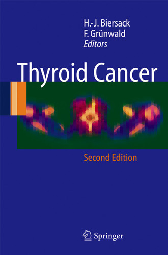 Thyroid Cancer book cover by 