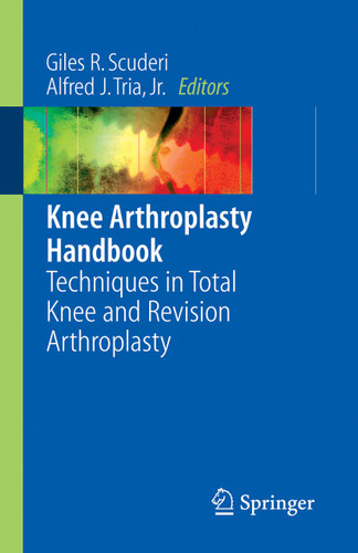 Knee Arthroplasty Handbook: Techniques in Total Knee and Revision Arthroplasty book cover by 