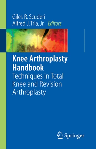 Knee Arthroplasty Handbook: Techniques in Total Knee and Revision Arthroplasty book cover by 