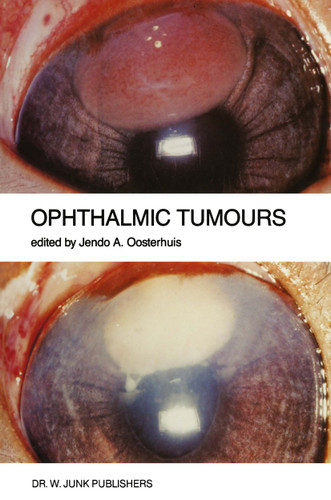 Ophthalmic Tumours: Including lectures presented at the Boerhaave Course on “Ophthalmic Tumours” of the Leiden Medical Faculty, held in Leiden, The Netherlands, on February 2–3, 1984 (Monographs in Ophthalmology #9) book cover by 