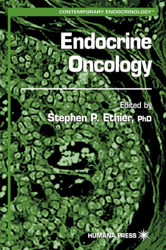 Endocrine Oncology (Contemporary Endocrinology) book cover by 