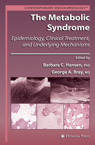 The Metabolic Syndrome:: Epidemiology, Clinical Treatment, and Underlying Mechanisms (Contemporary Endocrinology) book cover by 