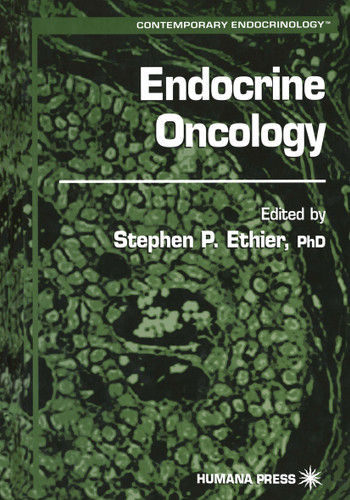 Endocrine Oncology (Contemporary Endocrinology) book cover by 
