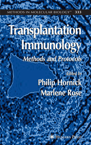 Transplantation Immunology: Methods and Protocols (Methods in Molecular Biology #333) book cover by 