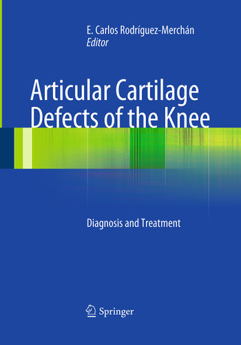 Articular Cartilage Defects of the Knee: Diagnosis and Treatment book cover by 