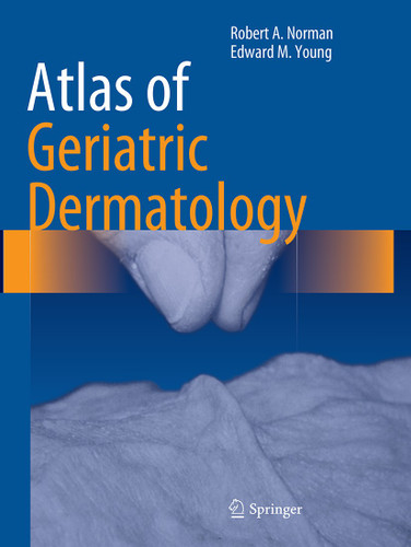 Atlas of Geriatric Dermatology book cover by Robert A. Norman, Edward M. Young, Jr