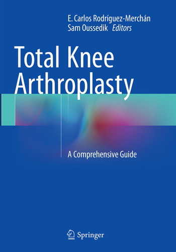 Total Knee Arthroplasty: A Comprehensive Guide book cover by 