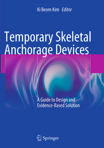 Temporary Skeletal Anchorage Devices: A Guide to Design and Evidence-Based Solution book cover by 