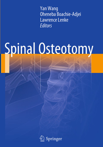 Spinal Osteotomy book cover by 
