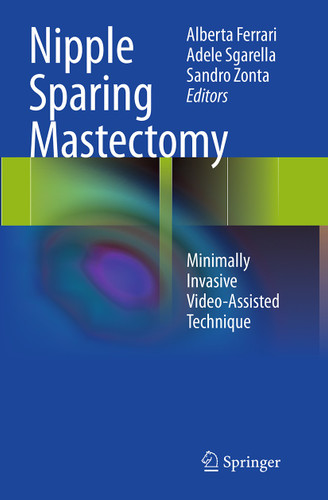 Nipple Sparing Mastectomy: Minimally Invasive Video-Assisted Technique book cover by 