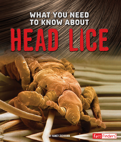 What You Need to Know about Head Lice (Focus on Health) book cover by Nancy Dickmann