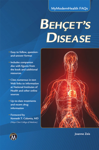 Behcet’s Disease (MyModernHealth FAQs) book cover by Joanne Zeis