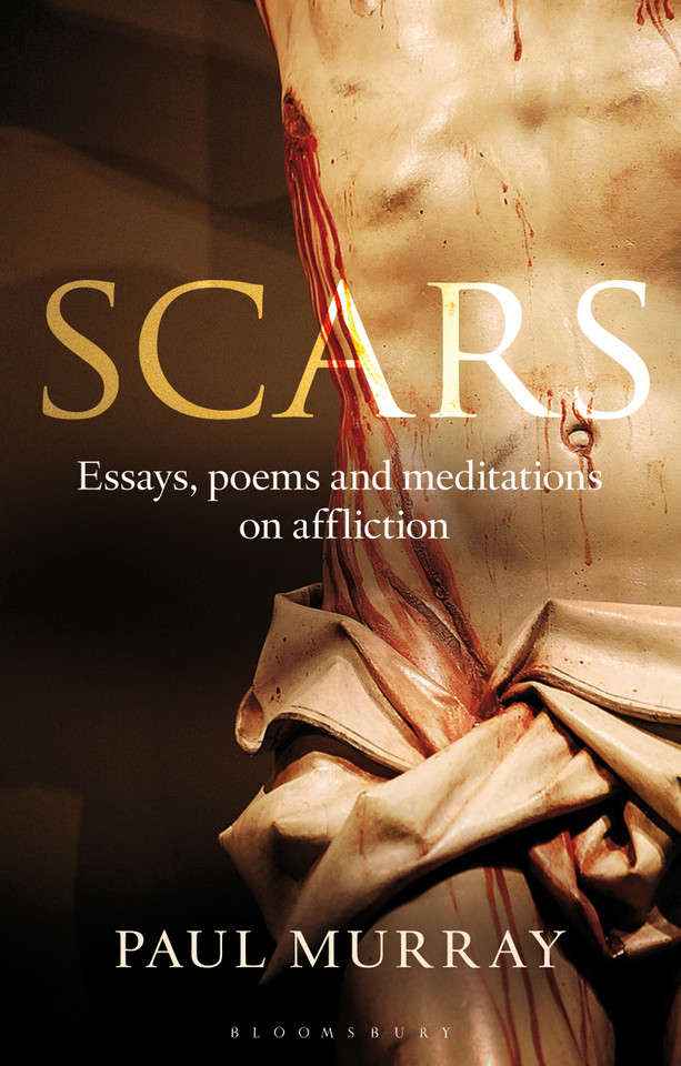 Scars: Essays, Poems and Meditations on Affliction book cover by Paul Murray OP