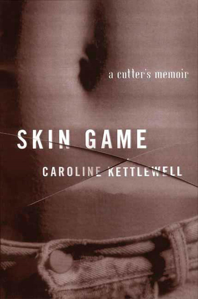 Skin Game: A Memoir book cover by Caroline Kettlewell