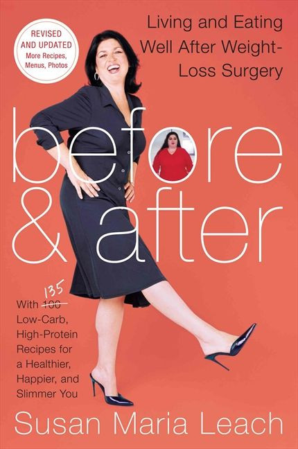 Before & After, Second Revised Edition: Living and Eating Well After Weight-Loss Surgery book cover by Susan Maria Leach