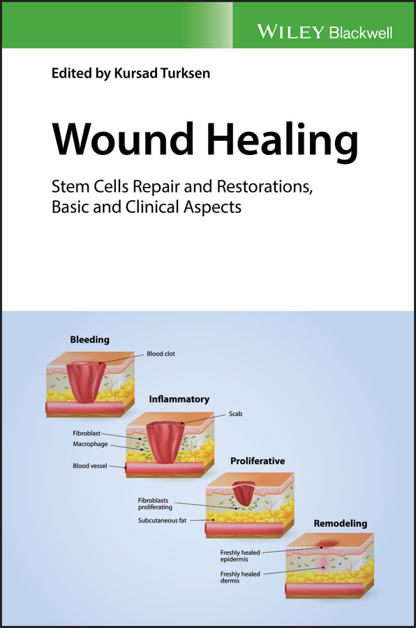 Wound Healing: Stem Cells Repair and Restorations, Basic and Clinical Aspects book cover by 