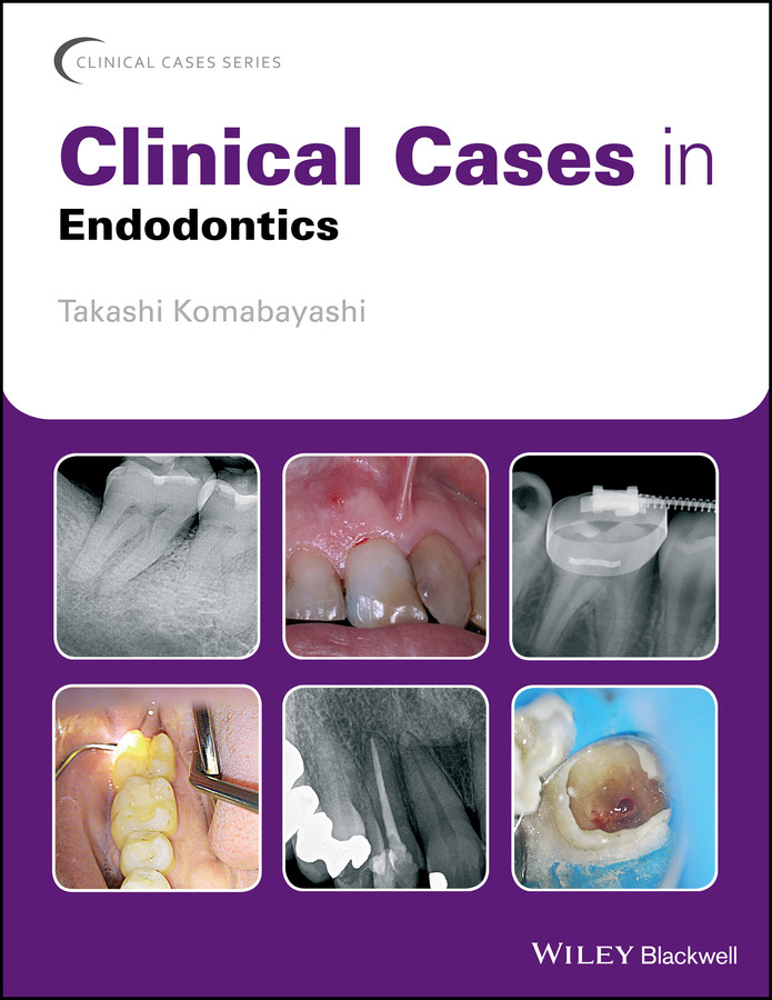 Clinical Cases in Endodontics (Clinical Cases (Dentistry)) book cover by Takashi Komabayashi