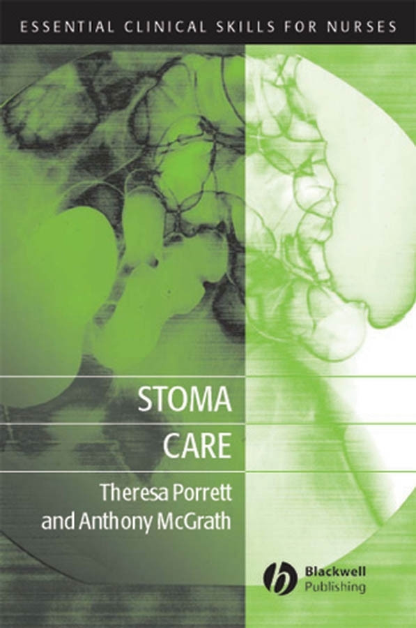 Stoma Care (Essential Clinical Skills for Nurses) book cover by Theresa Porrett, Anthony McGrath