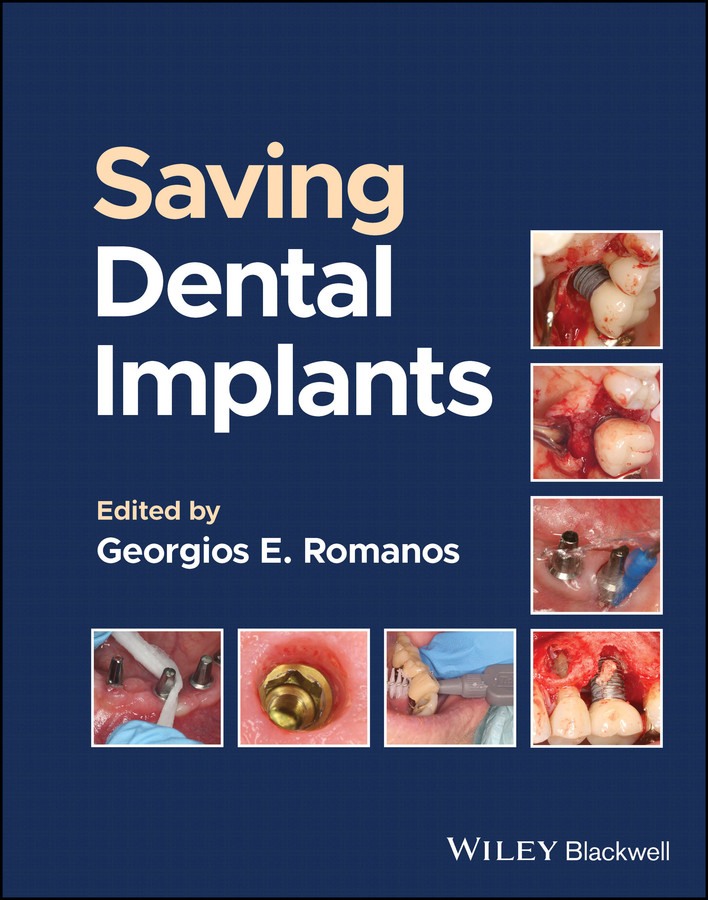 Saving Dental Implants book cover by 