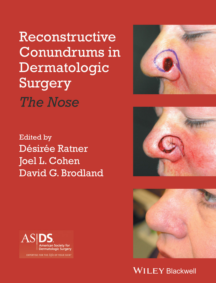Reconstructive Conundrums in Dermatologic Surgery: The Nose book cover by 