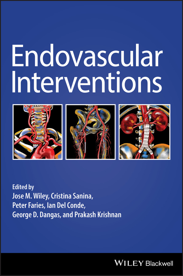 Endovascular Interventions book cover by 