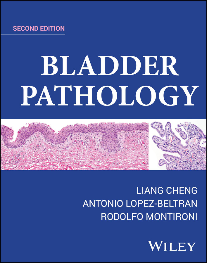 Bladder Pathology book cover by Liang Cheng, Antonio Lopez-Beltran, Rodolfo Montironi
